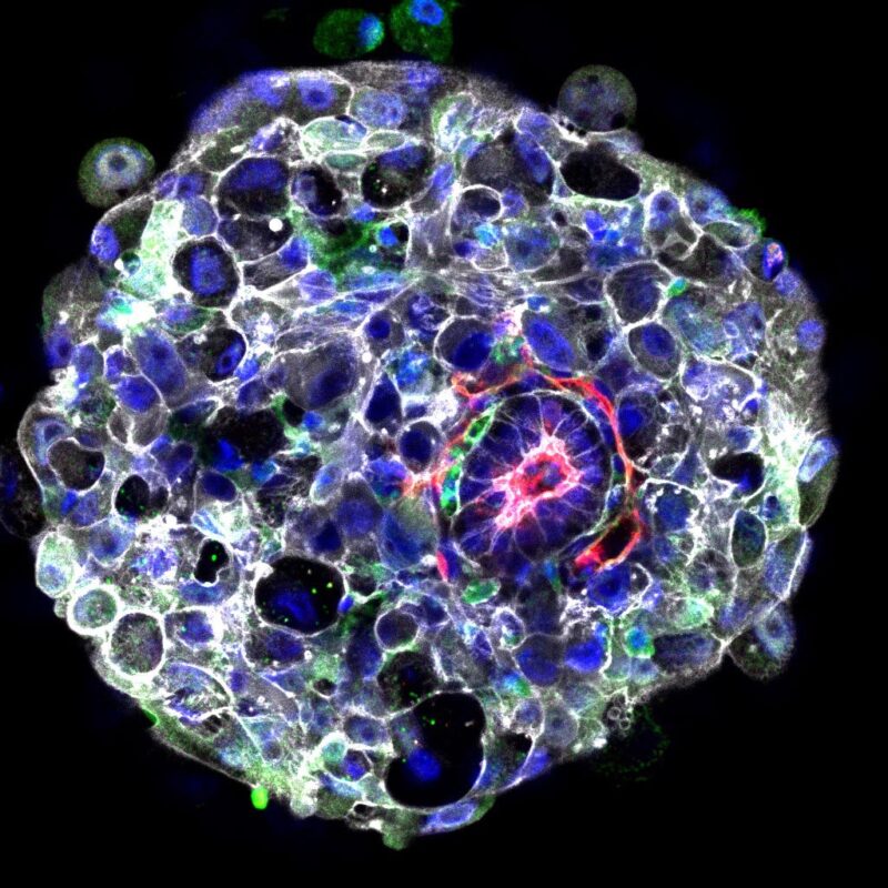Human Embryo 9 Days After Fertilization