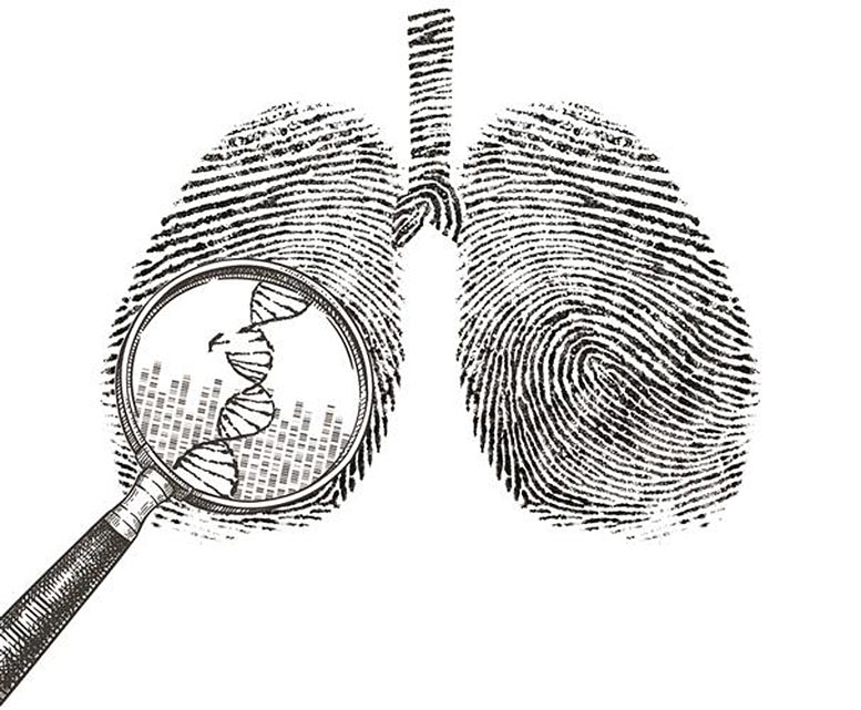Recherche sur le cancer du poumon