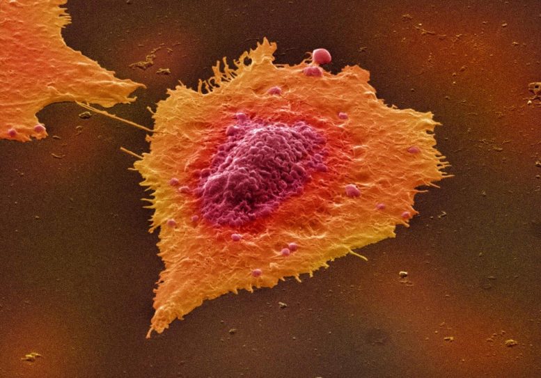 Cellules humaines du cancer du côlon