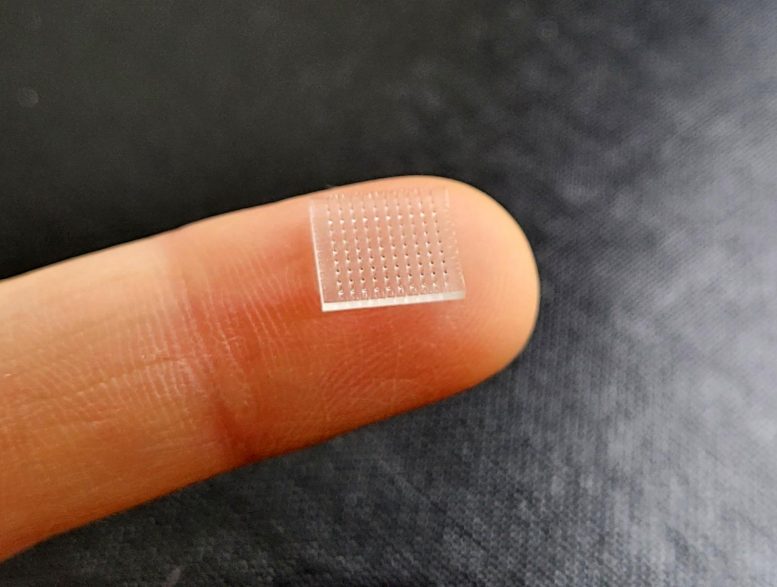 Patch de vaccin Microneedle imprimé en 3D