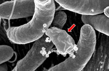 Guerre dans l'intestin : comment les microbes de l'intestin humain résistent à la bactérie du choléra