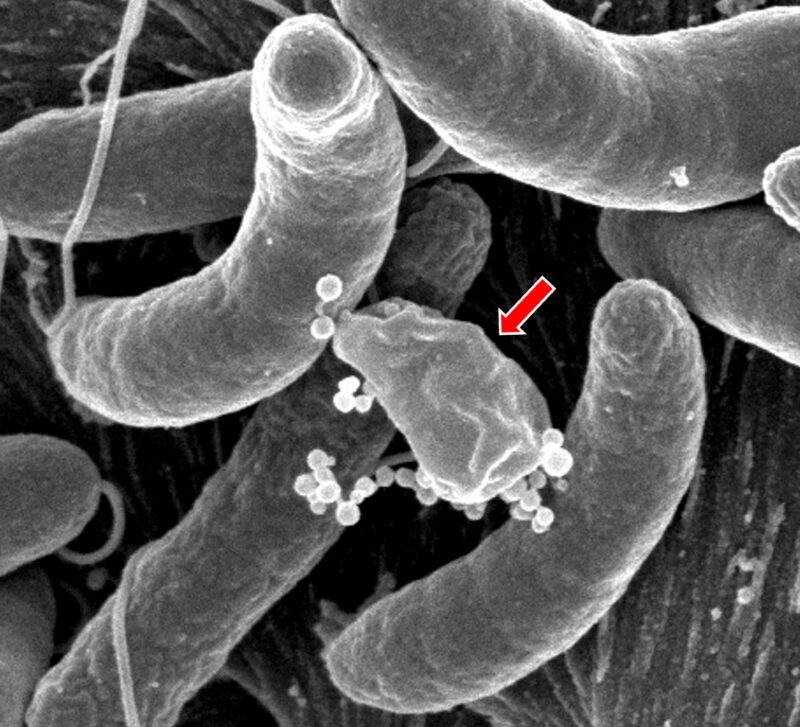 Guerre dans l'intestin : comment les microbes de l'intestin humain résistent à la bactérie du choléra