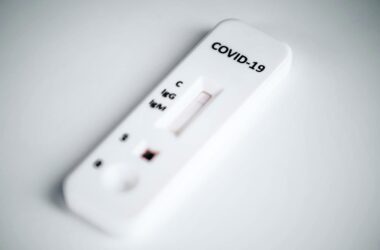 COVID-19 IgG Antibody Test
