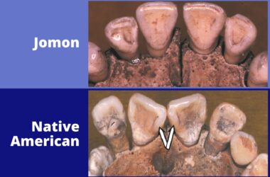 Jomon and Native American Teeth