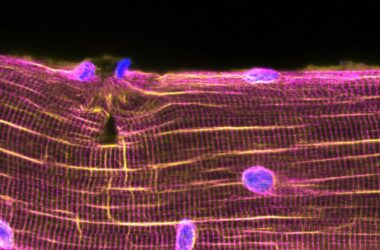 Muscle Lesions Attract Myonuclei To Repair the Damage