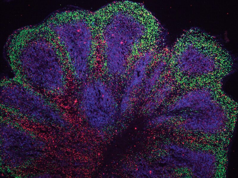 Des scientifiques font pousser des « mini-cerveaux » en laboratoire – trouvent une voie de traitement potentielle pour une maladie neurologique mortelle