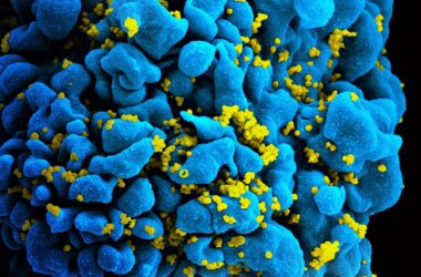 Des scientifiques identifient comment deux personnes ont contrôlé le VIH après avoir arrêté le traitement antirétroviral