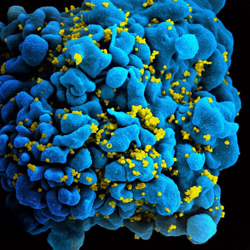 Des scientifiques identifient comment deux personnes ont contrôlé le VIH après avoir arrêté le traitement antirétroviral