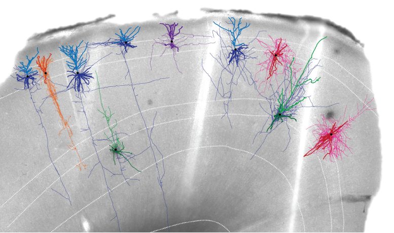 Image de tissu cérébral humain avec reconstructions de neurones