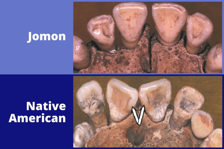 Jomon et les dents amérindiennes