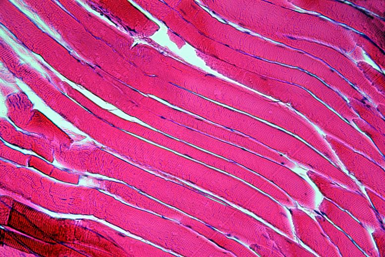 Cellules de fibres musculaires