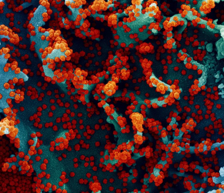 Micrographie électronique à balayage colorisée d'une cellule infectée par le SRAS-CoV-2