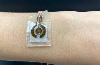 Wearable, Noninvasive Glucose Sensor
