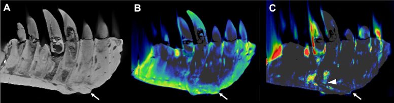 CT Reconstructions de dents dentaires à roulement T Rex