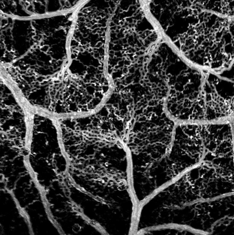 Carte du réseau de vaisseaux sanguins
