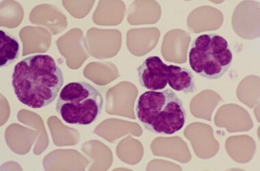 Virus-Induced Leukaemia Cells