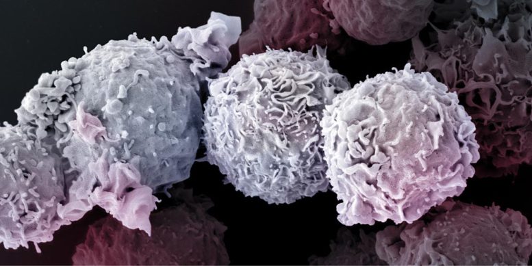 Image au microscope électronique des cellules T