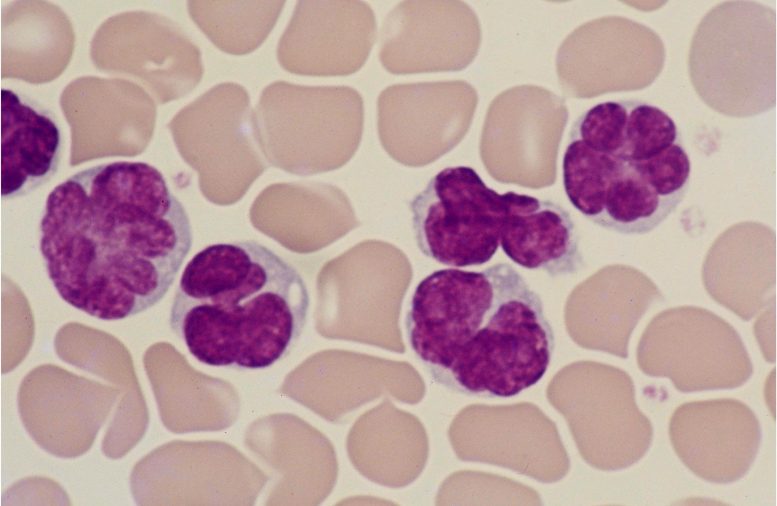 Cellules de leucémie induite par un virus