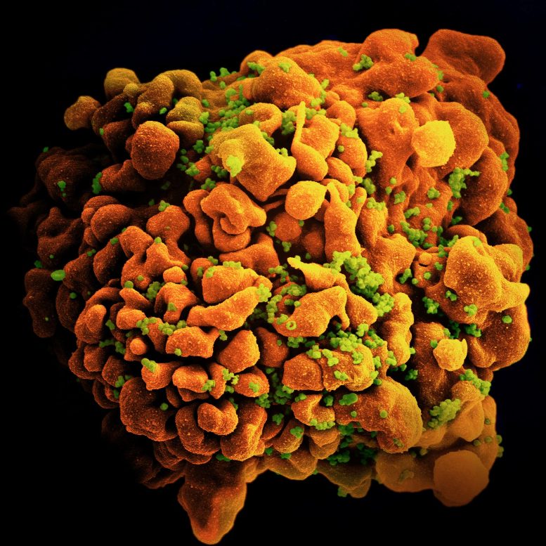 Micrographie électronique à balayage d'une cellule T H9 infectée par le VIH.