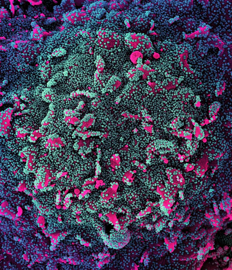 Infection par le SRAS-CoV-2 d'une cellule humaine