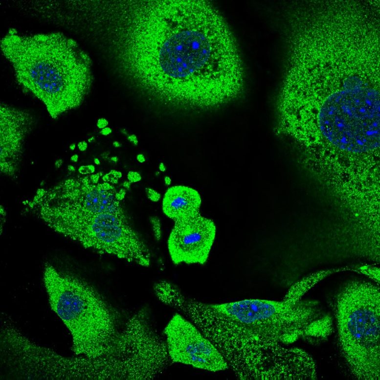 Le kératinocyte subit une division cellulaire