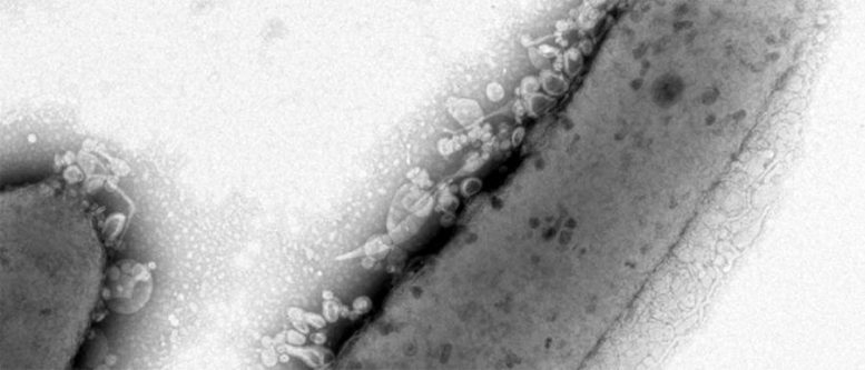 Gouttelettes lipidiques sur l'extérieur de la paroi cellulaire bactérienne