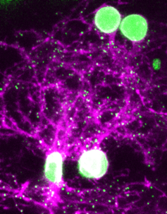 Image de neurones de couleur magenta dans un cerveau de poisson vivant, avec les synapses colorées en vert.