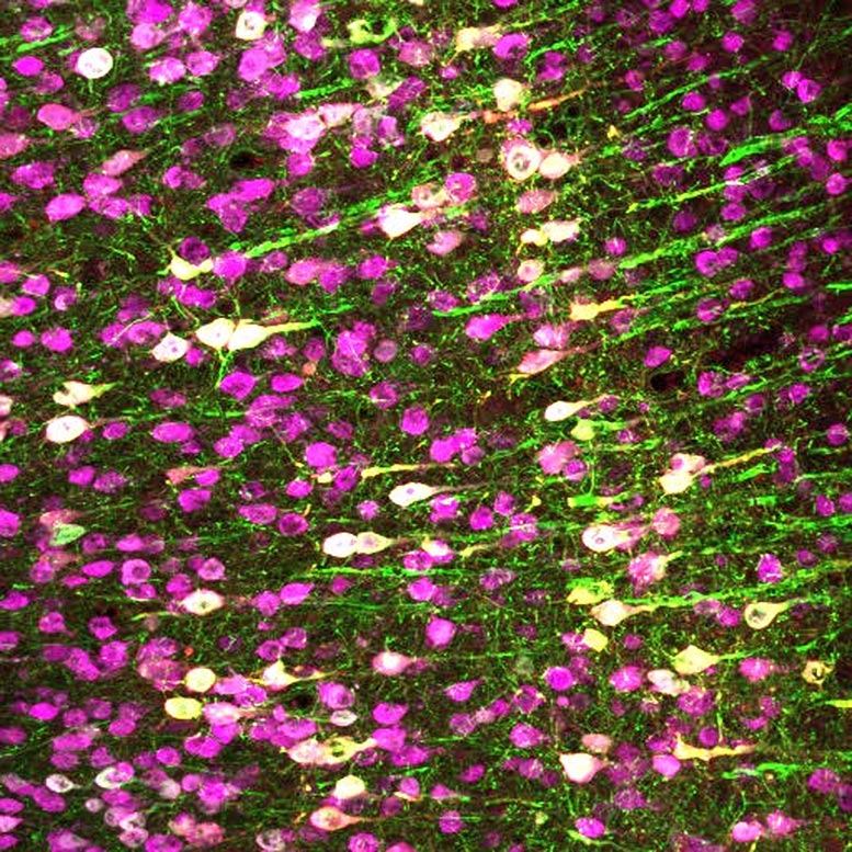 Neurones TRPA1 dans le cerveau de la souris