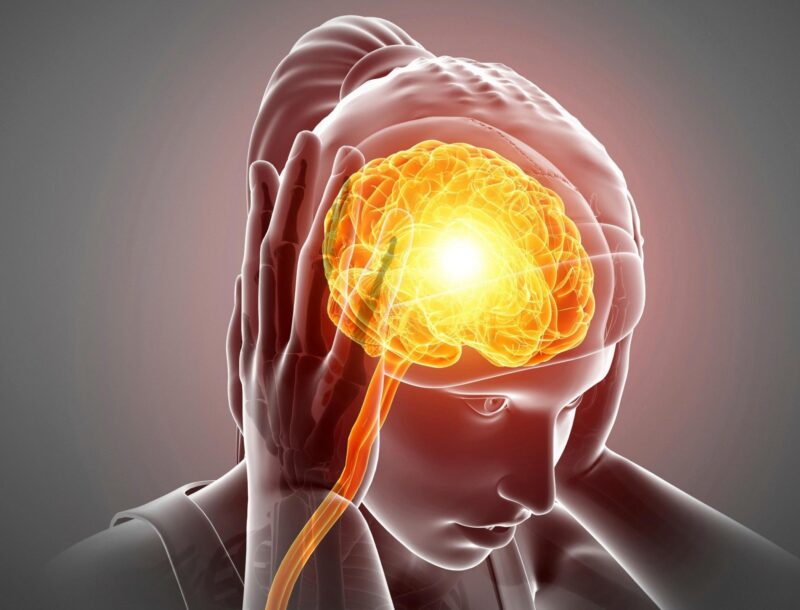 Une étude révolutionnaire du génome de la migraine révèle de nouveaux facteurs de risque génétique