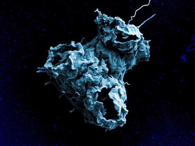 Surface cellulaire de l'amibe Naegleria gruberi