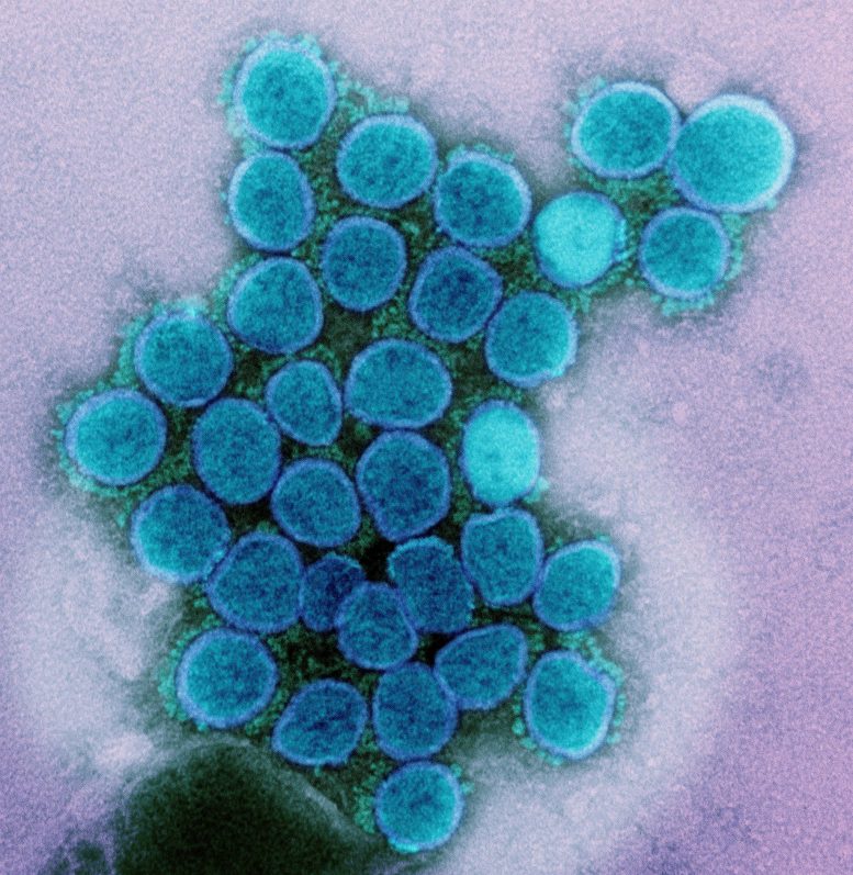 SARS-CoV-2 Alpha Variant Virus Particles