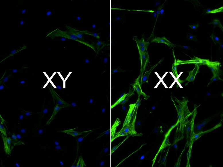 Tissu cardiaque Chromosomes XX vs XY