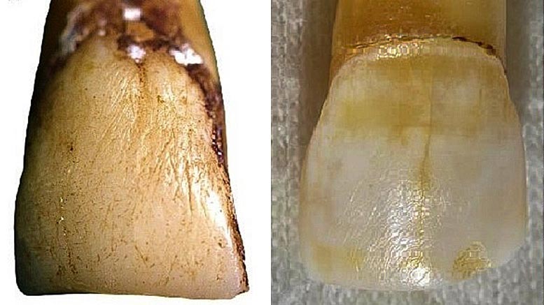 Dents de macaques et de néandertaliens de l'île de Koshima