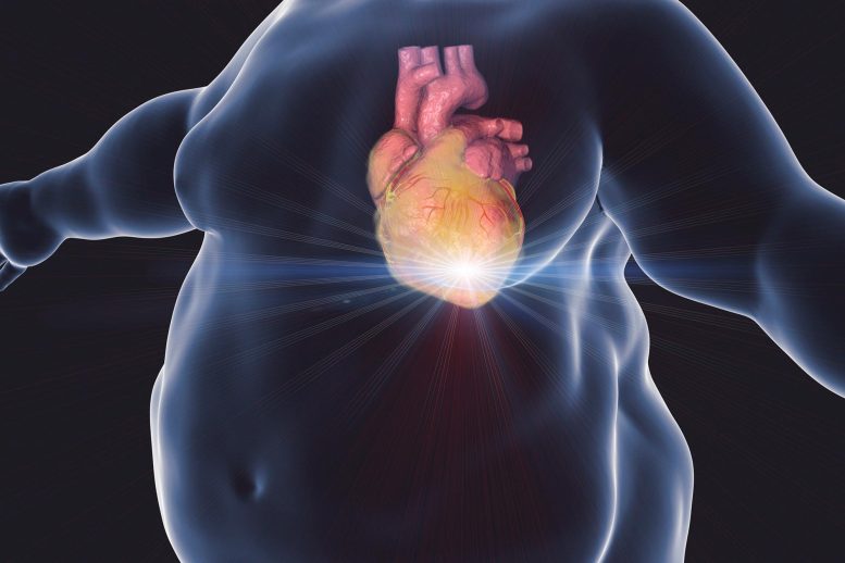 Illustration d'une crise cardiaque chez un homme obèse