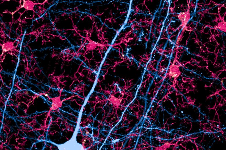 Neurone avec extensions et cellules microgliales