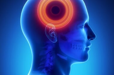 Brain Disease Head Pain Concept