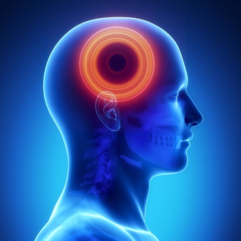 Brain Disease Head Pain Concept