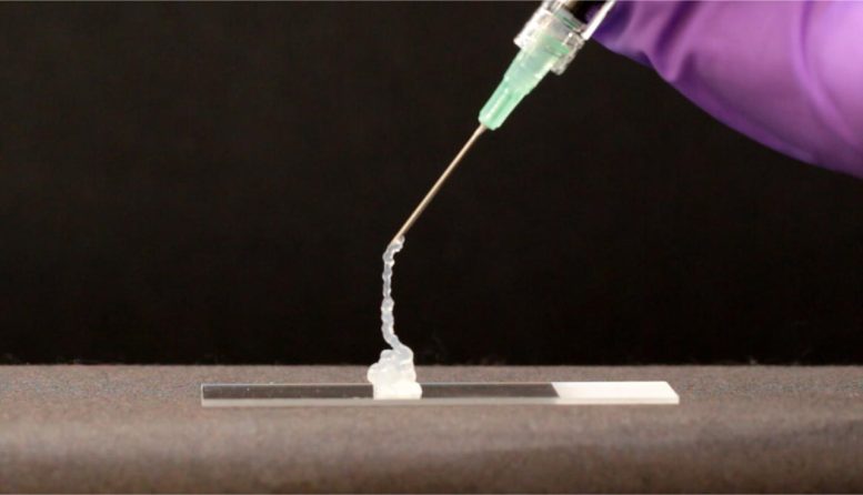 Injection d'hydrogel