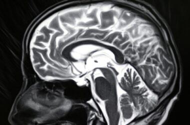 Human Brain MRI Image