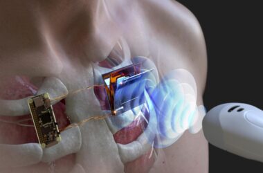 Utilisation d'ondes ultrasoniques pour charger des dispositifs électroniques immergés et implantés dans le corps humain
