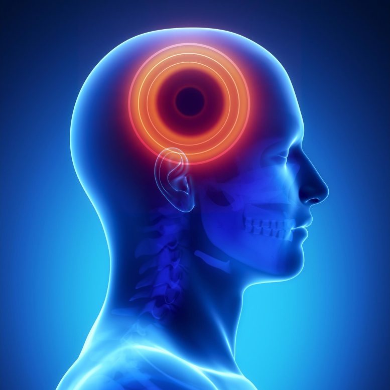 Concept de douleur de tête pour les maladies du cerveau