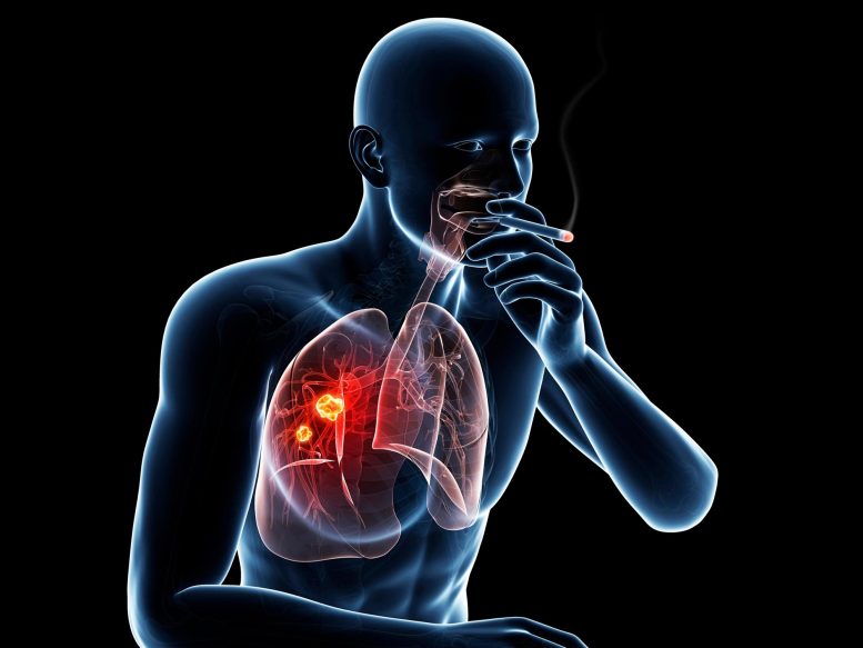Illustration du cancer du poumon chez les fumeurs