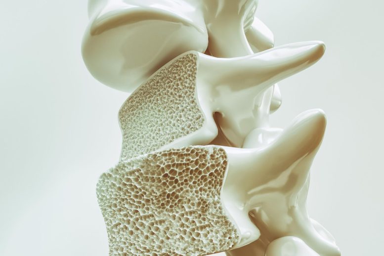 L'ostéoporose dans la colonne vertébrale