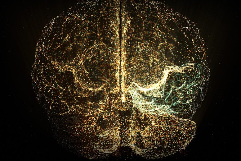 Scanner holographique du cerveau