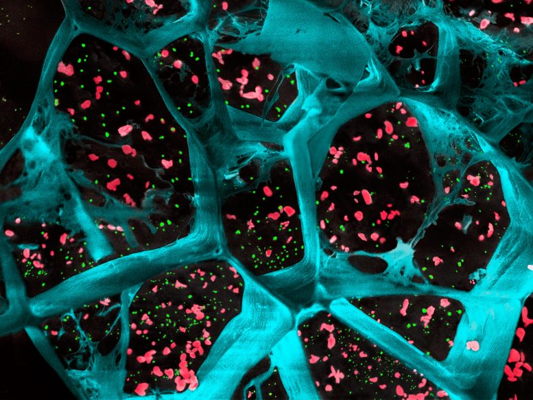 Hydrogel encapsulant des plaquettes et des nanoparticules activatrices de cellules T