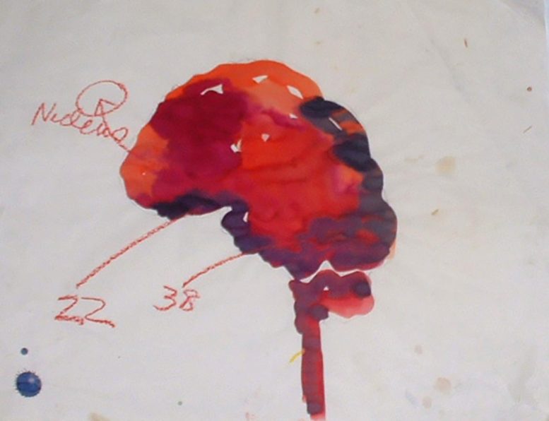 Cerveau avec zones de Brodmann marquées