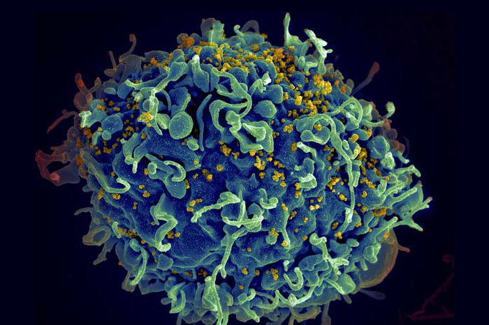 Cellules T Virus VIH