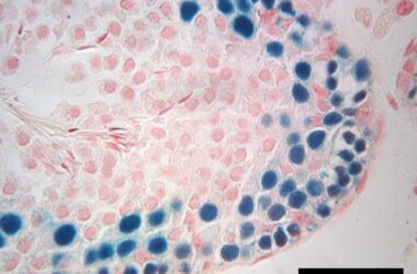 Cross Section of Infertile Mouse Testis