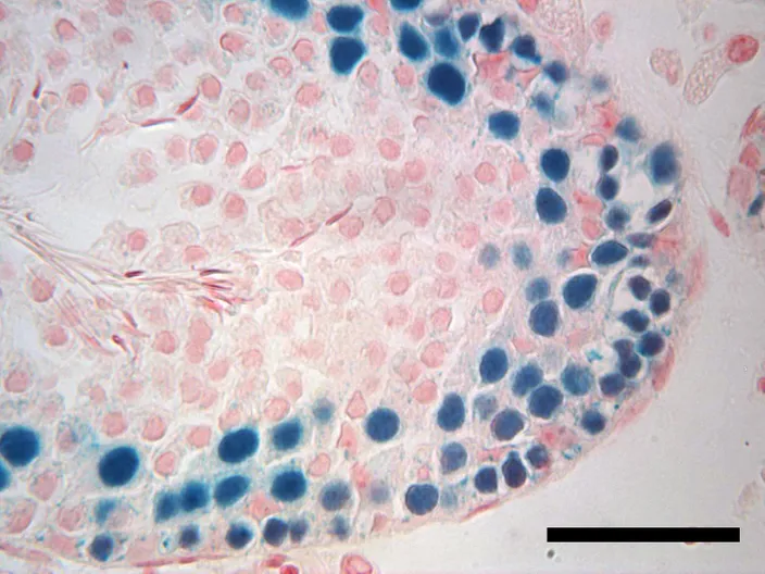 Coupe transversale d'un testicule de souris infertile