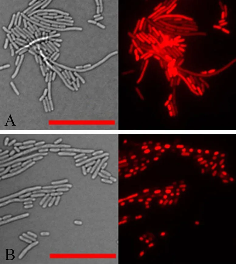 Images au microscope d'E. coli exposé à une protéine antibactérienne.